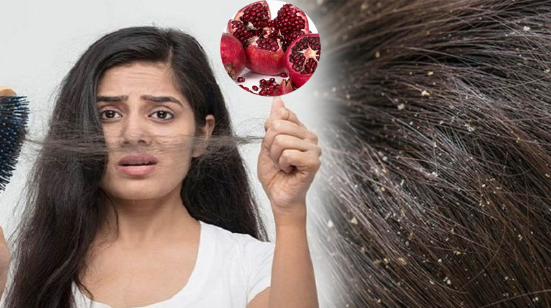 চুল পড়া ও খুশকি দূর করতে বেদানার ব্যবহার