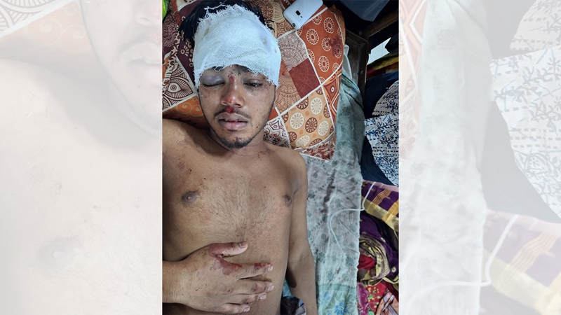 সন্ত্রাসী হামলায় যুবককে হত্যা চেষ্টা, থানায় মামলা
