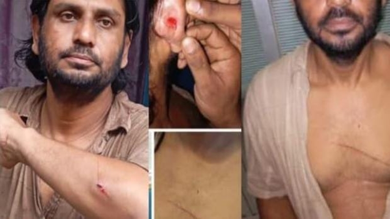 বাঁশখালীতে সম্পত্তি লিখে না দেওয়ায় হামলার অভিযোগ