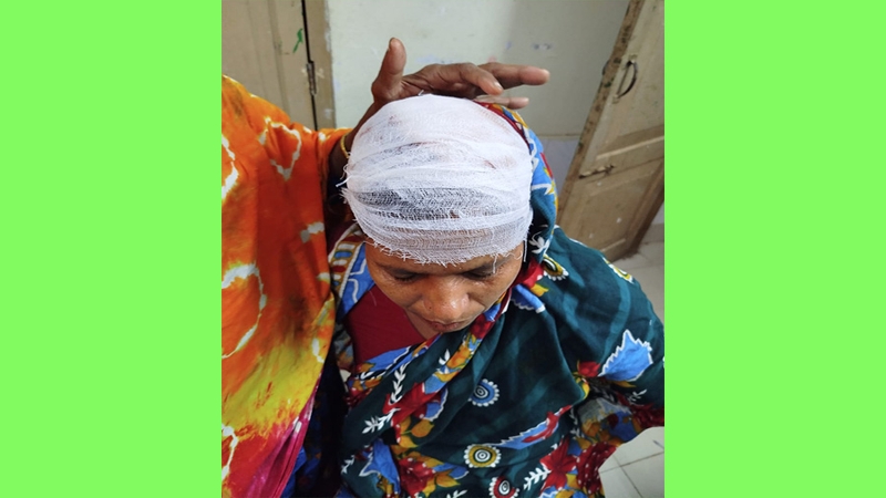 কুমারখালীতে পূর্ব শত্রুতার জেরে হামলায় আহত ১