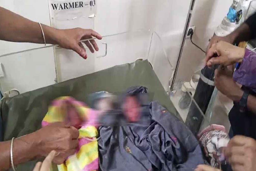 নির্ধারিত সময়ের আগেই জন্ম নেওয়ায় সংকটাপন্ন অবস্থায় রাখা হয়েছে অক্সিজেন সাপোর্টে। ছবি: ভিওডি বাংলা