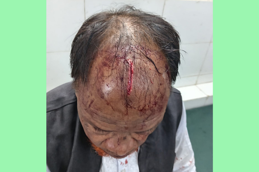 বাঁশখালীতে আবুল হোসেনের ওপর পরিকল্পিত হত্যাচেষ্টা