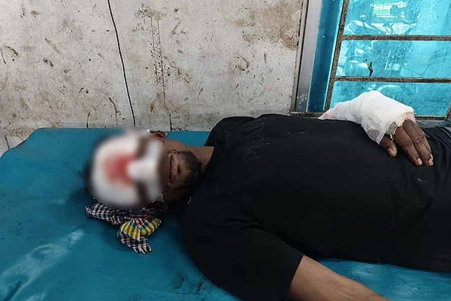 হাসপাতালে ঢুকে চিকিৎসাধীন যুবককে কোপালো প্রতিপক্ষ