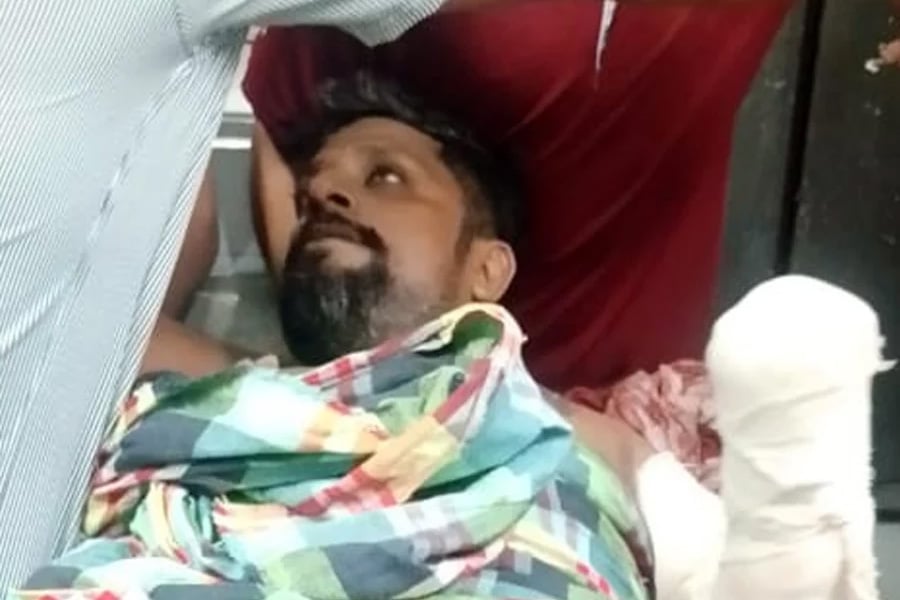 গুরুতর আহত অবস্থায় চুয়াডাঙ্গা থেকে ঢাকার পঙ্গু হাসপাতালে নেওয়া হয় জাহিন শেখকে। ছবি: সংগৃহীত