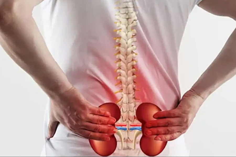 কিডনিতে সমস্যা হলে শরীরে কোথায় কোথায় ব্যথা হয়?