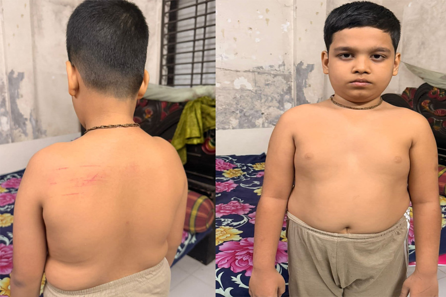লোহাগড়ায় পঞ্চম শ্রেণির ছাত্রকে অমানবিক নির্যাতনের অভিযোগ