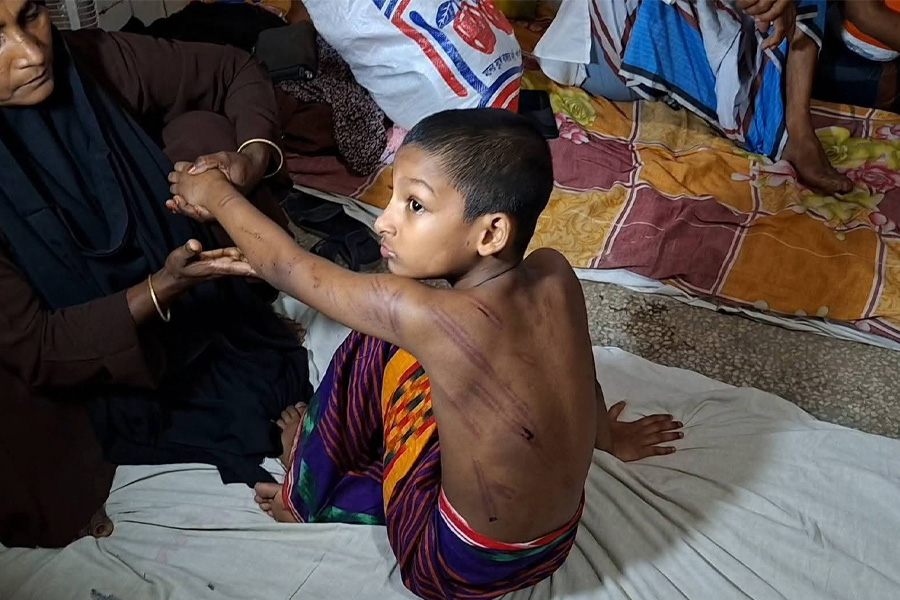 নরসিংদীতে মাদরাসায় শিক্ষকের প্রহারে শিশু রক্তাক্ত, হাসপাতালে ভর্তি