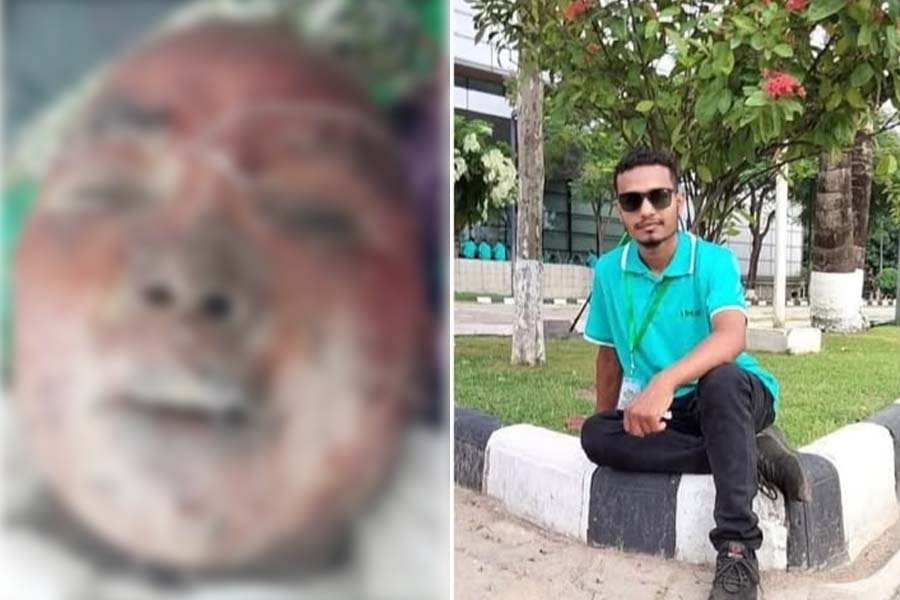 পেট্রোল ঢেলে আগুন দেওয়া গৃহবধূর ৭ দিন পর মৃত্যু