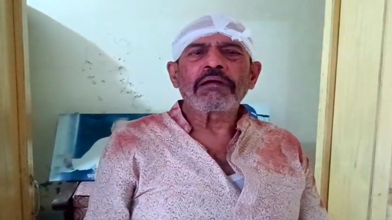 প্রকাশ্য দিবালোকে নিজ বাড়িতে প্রবীণ অধ্যাপককে কোপালো দুর্বৃত্তরা