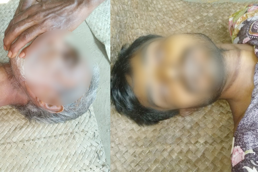 পাংশায় মানসিক রোগাক্রান্ত বৃদ্ধ ও মাদকাসক্ত যুবকের আত্মহত্যা