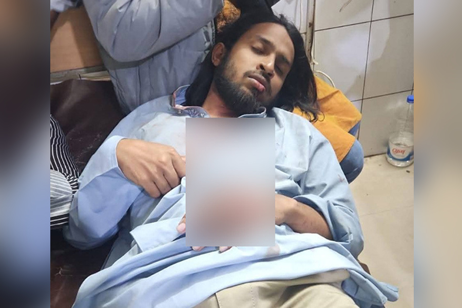 ইন্টারকন্টিনেন্টালের সামনে সংঘর্ষে রাকসু জিএস আম্মার আহত