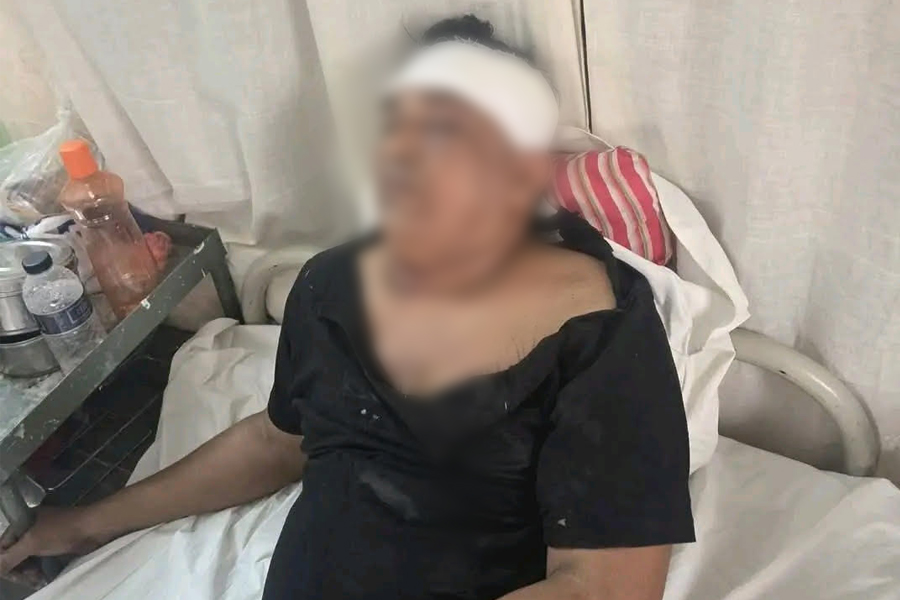 সন্ত্রাসী হামলায় আহত চৌগাছার সাবেক কাউন্সিলর শাহিনুরের মৃত্যু