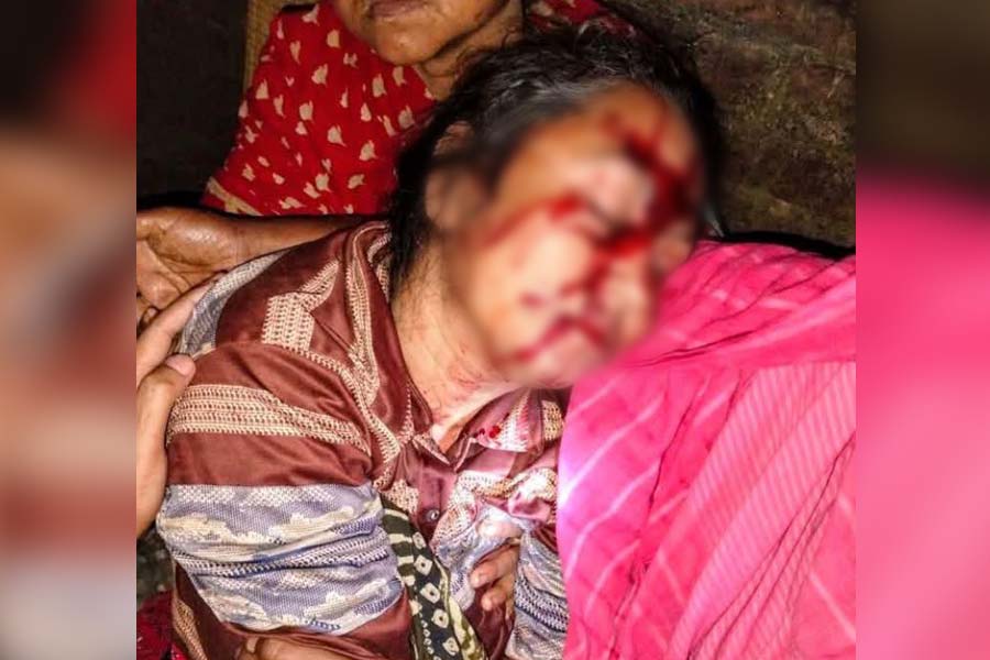 ভাঙ্গুড়ায় ভাড়াটিয়া বিরোধে গৃহবধূকে মারধর, থানায় অভিযোগ