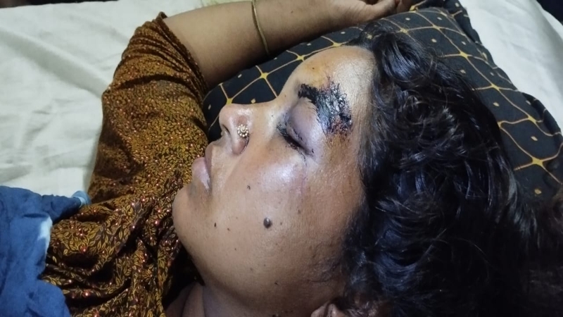 কুড়িগ্রাম সদর হাসপাতালে মহিলা ওয়ার্ডে দূর্বৃত্তের হামলা আহত ২