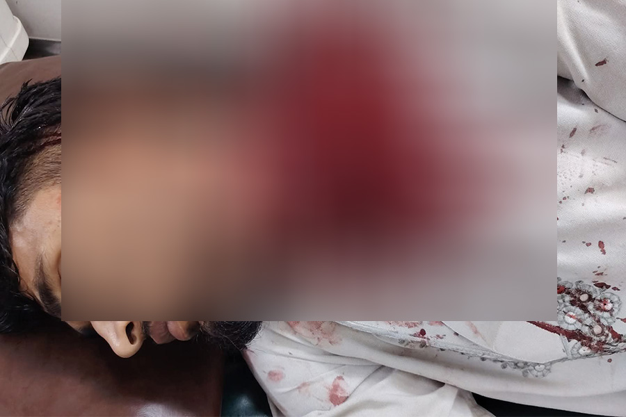 বাঁশখালীতে জামায়াত নেতার হামলায় যুবদল নেতা আহত