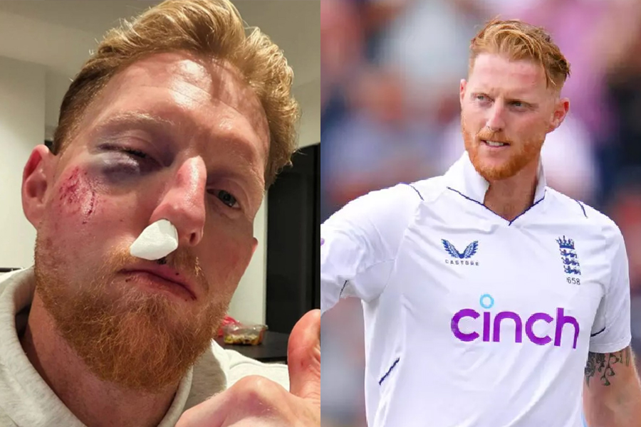 বলের আঘাতে গুরুতর আহত বেন স্টোকস