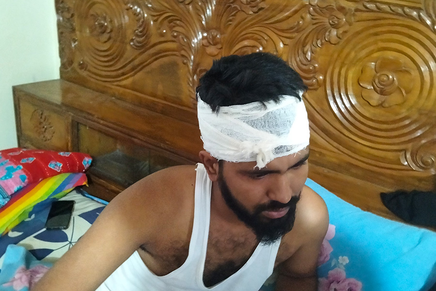 চৌদ্দগ্রামে প্রবাসীর উপর হামলা
