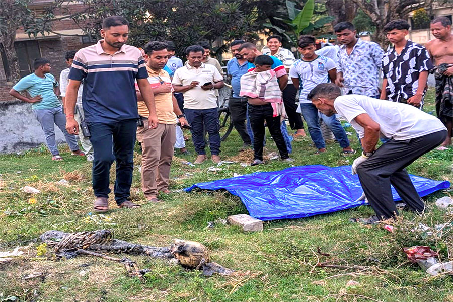 হাসপাতালের ম্যানহোল থেকে কঙ্কালের অংশ বিশেষ উদ্ধার