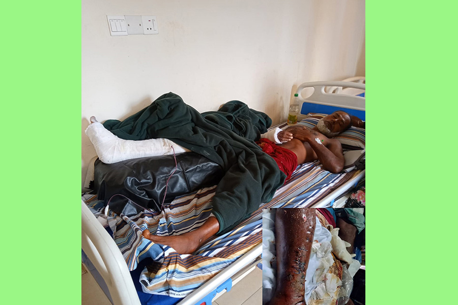 রাজারহাটে বড় ভাইয়ের হাত-পা ভেঙ্গে দিয়েছে ছোট ভাই