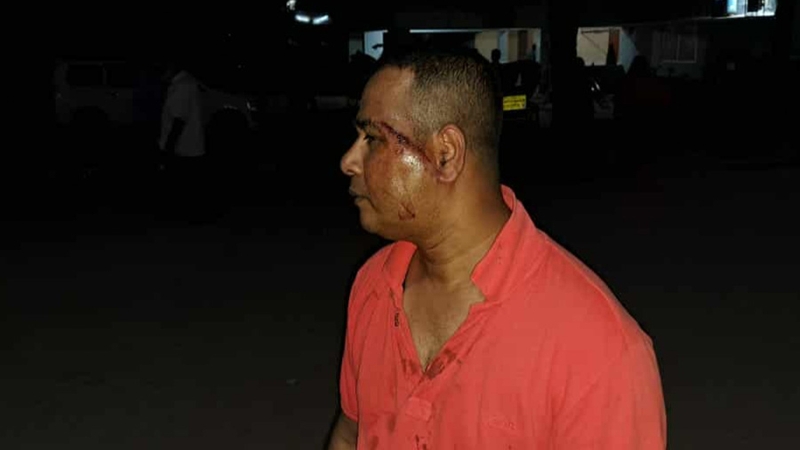 রাজবাড়ীতে বিএনপি নেতার হামলায় ইতালি প্রবাসী আহত