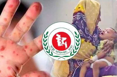 ২৪ ঘণ্টায় হাম ও উপসর্গে ১১ শিশুর মৃত্যু, আক্রান্ত ১৩১৫