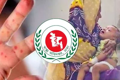 ২৪ ঘণ্টায় হাম ও উপসর্গে আরও ৮ শিশুর মৃত্যু, মোট প্রাণহানি ৬২৮