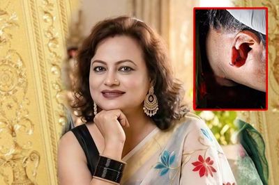 ছিনতাইকারীর টানে কান ছিঁড়ে গেছে রঞ্জিতা কনার