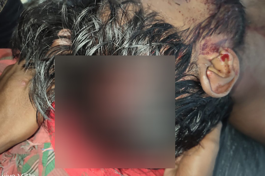 ভাঙ্গুড়ায় পরিকল্পিত হামলায় যুবক কে কুপিয়ে জখম